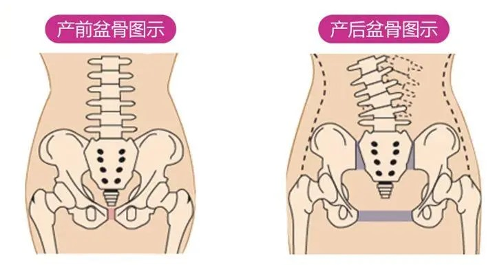 产后修复对女性有多重重要，快来看看