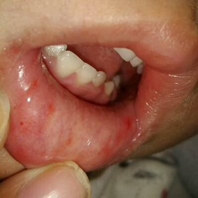 不要回避，儿童性心理发展的五个阶段，家长快来看