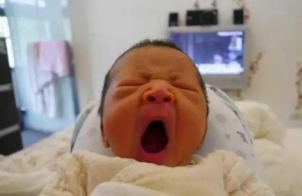 新生儿黄疸全解析：成因、预防与护理