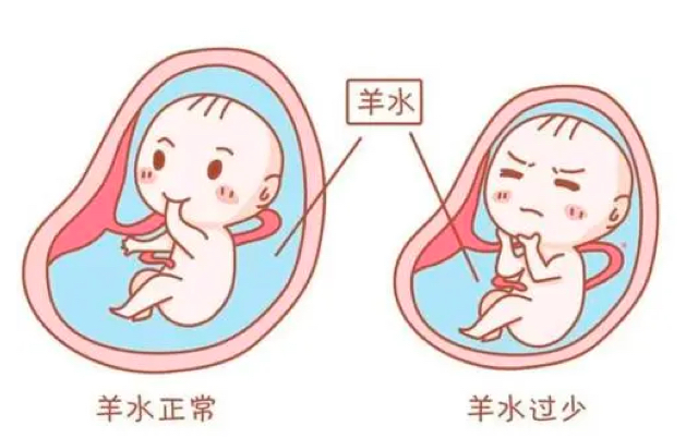 孕期小科普，脐带、胎盘、羊水如何守护宝宝健康长大