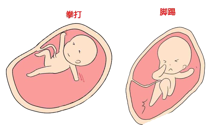 三种异常胎动，妈妈们一定要清楚