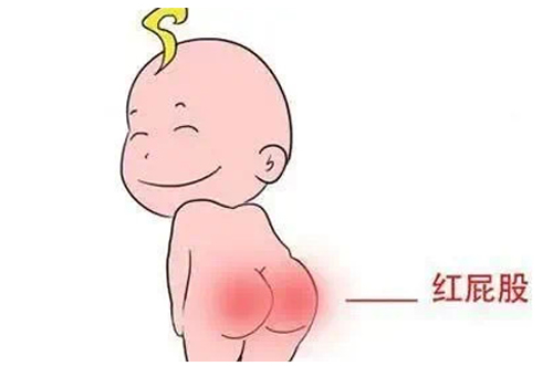 宝宝红臀该如何处理?