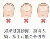 婴儿指甲修剪指南